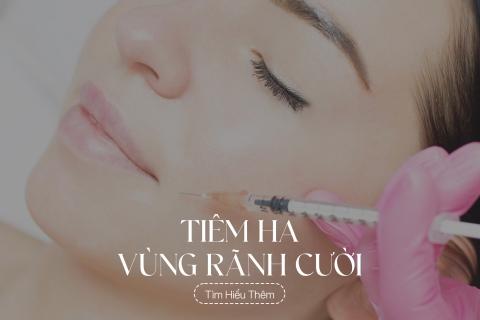 Tiêm HA vùng rãnh cười